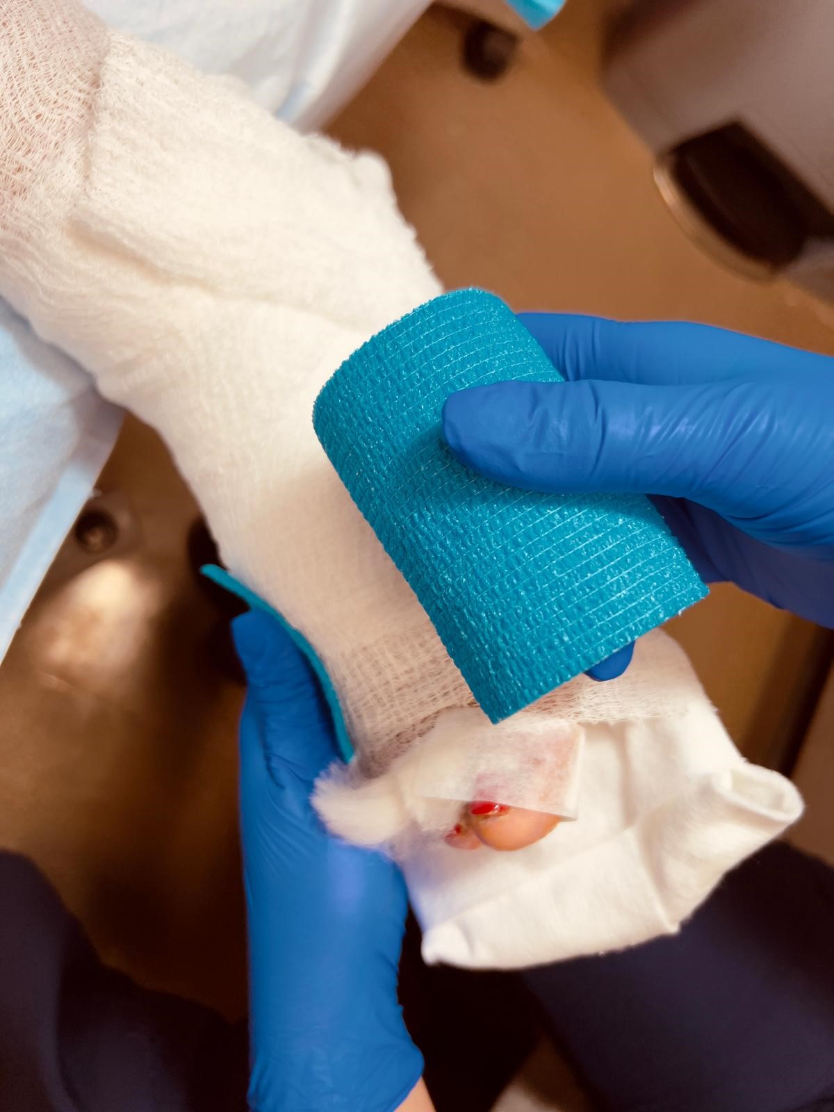 Advanced wound care compression technique